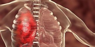 கொரோனா நோயாளிகளுக்கு ரத்தம் உறையும் பிரச்சனை ஏற்படுவது ஏன்? ரத்தம்