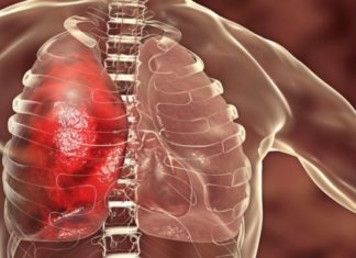 கொரோனா நோயாளிகளுக்கு ரத்தம் உறையும் பிரச்சனை ஏற்படுவது ஏன்? ரத்தம்